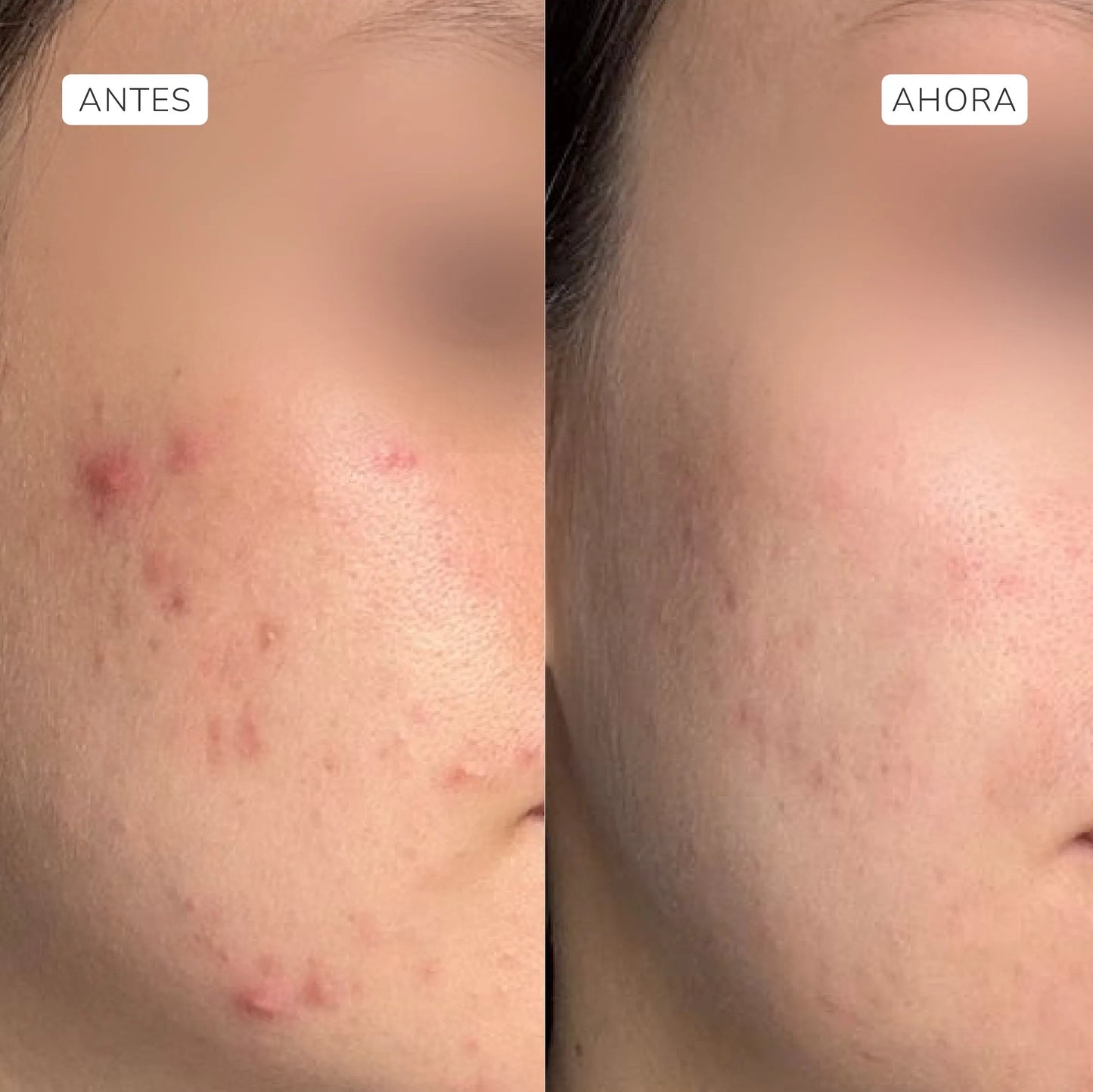 Sérum exfoliante ácido glicólico 5% + láctico (Nueva fórmula) - ARUNÁ