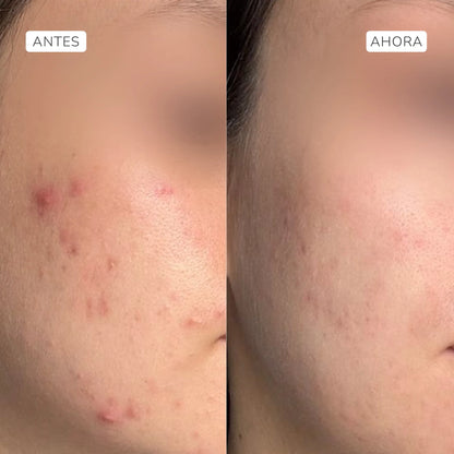 Sérum exfoliante ácido glicólico 5% + láctico (Nueva fórmula) - ARUNÁ